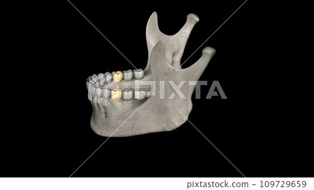 The mandibular first molar usually has two roots, a mesial and a distal 109729659