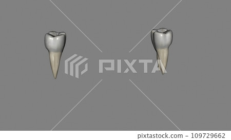 The mandibular first molar usually has two roots, a mesial and a distal 109729662