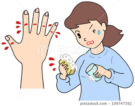 疾病/疾病 - 乾裂/破裂/破裂的濕疹 疾病/疾病 - 乾裂/破裂/破裂的濕疹 109747392