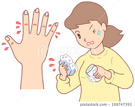 疾病/疾病 - 乾裂/破裂/破裂的濕疹 疾病/疾病 - 乾裂/破裂/破裂的濕疹 109747393