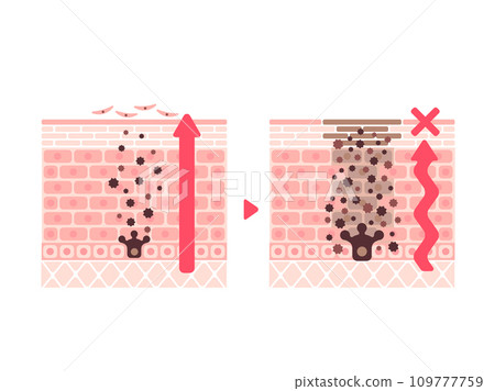 Comparison illustration of turnover of healthy skin and skin with spots 109777759