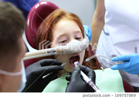 Treatment of baby teeth. Nitrous oxide for anesthesia of the child. Dental treatment for a child. Anesthesia for children in dental treatment. 109787869