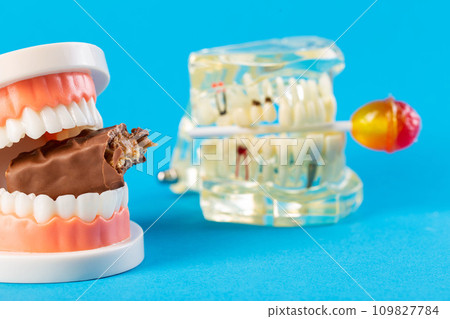Two mock-ups of dental jaws with a lollipop and a chocolate bar on a blue background. The concept of the destructive effect on tooth enamel and teeth after eating sweets. Caries and pulpitis in 109827784
