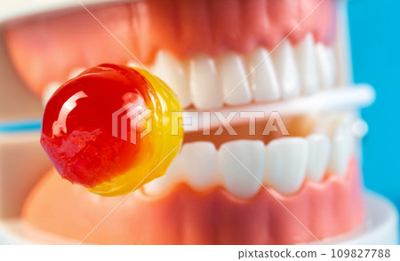 Candy on a stick in a tooth jaw mockup on a blue background. Concept of the effect of candies and sweets on the oral cavity and tooth enamel. Tooth destruction by sweet bacteria. Pulpitis and caries 109827788