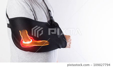 A man's arm in a black bandage for immobilization of the elbow joint after an injury. Bandage for rehabilitation after fractures of the humerus, ulna and radius. Sprain, traumatology. Copy space for 109827794