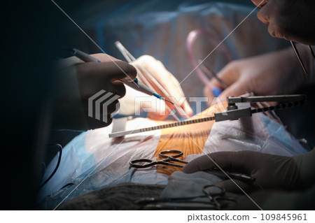 Closeup of professional doctor hands operating a patient during open heart surgery in surgical room. Healthcare and medical intervention concept 109845961