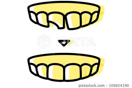 Dental: Direct bonding before and after, simple line drawing Dental: Direct bonding before and after, simple line drawing 109854190