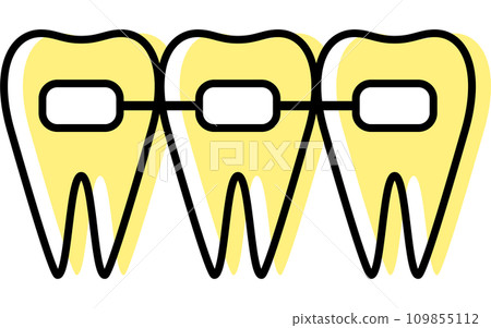 Dentistry: Metal brackets, orthodontic appliances used to correct tooth alignment 109855112