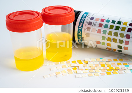 Urinalysis, urine cup with reagent strip pH paper test and comparison chart in laboratory. 109925389