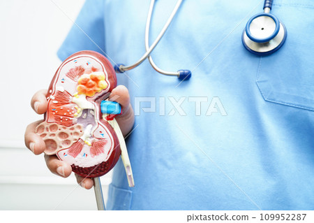 Chronic kidney disease, doctor with model for treatment urinary system, urology, Estimated glomerular filtration rate eGFR. 109952287