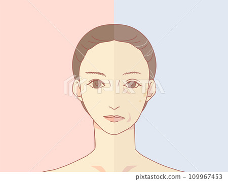 Before and after illustrations of aging signs that appear on the face 109967453