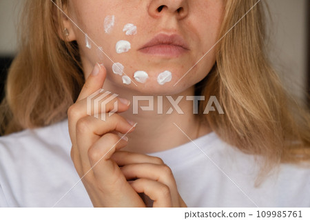 Unrecognizable woman applies makeup, cream serum cure for acne on face. Close-up acne on woman's face with rash skin ,scar and spot that allergic to cosmetics. Problem skincare and health concept 109985761