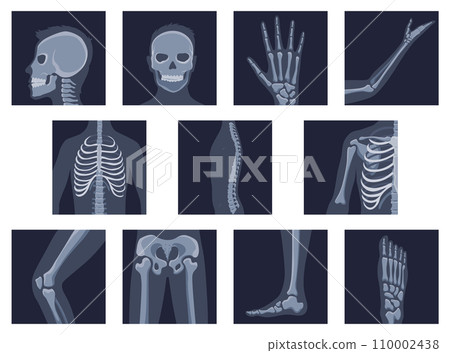 Human bones orthopedic and skeleton icon set, bone x-ray image of human joints, anatomy skeleton flat design vector illustration 110002438