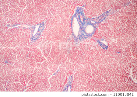 Structure of Tissue of Spleen Human, Liver Human and Kidney Human under the microscope in Lab. Structure of Tissue of Spleen Human, Liver Human and Kidney Human under the microscope in Lab. 110013841
