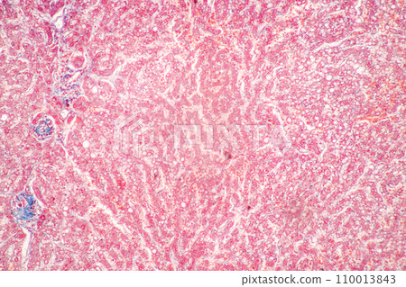 Structure of Tissue of Spleen Human, Liver Human and Kidney Human under the microscope in Lab. Structure of Tissue of Spleen Human, Liver Human and Kidney Human under the microscope in Lab. 110013843