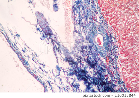 Structure of Tissue of Spleen Human, Liver Human and Kidney Human under the microscope in Lab. 110013844