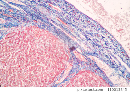 Structure of Tissue of Spleen Human, Liver Human and Kidney Human under the microscope in Lab. Structure of Tissue of Spleen Human, Liver Human and Kidney Human under the microscope in Lab. 110013845