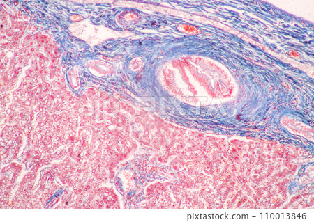 Structure of Tissue of Spleen Human, Liver Human and Kidney Human under the microscope in Lab. 110013846