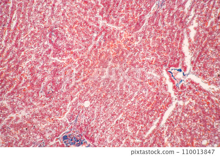 Structure of Tissue of Spleen Human, Liver Human and Kidney Human under the microscope in Lab. 110013847