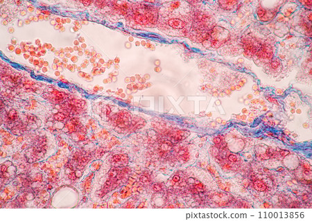 Structure of Tissue of Spleen Human, Liver Human and Kidney Human under the microscope in Lab. Structure of Tissue of Spleen Human, Liver Human and Kidney Human under the microscope in Lab. 110013856