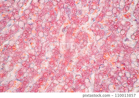Structure of Tissue of Spleen Human, Liver Human and Kidney Human under the microscope in Lab. Structure of Tissue of Spleen Human, Liver Human and Kidney Human under the microscope in Lab. 110013857