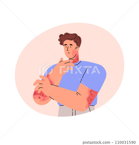Man with skin problem on hands. Vector illustration in flat style. 110031590