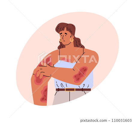 Woman with skin diseases. Vector illustration in flat style on white. Woman with skin diseases. Vector illustration in flat style on white. 110031603