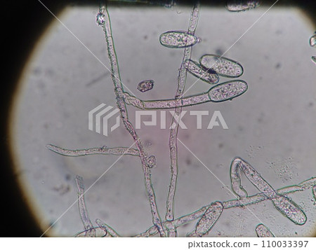 黴菌孢子從菌絲中生長出來 110033397