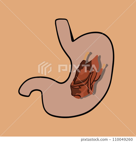 Vector isolated illustration of meat digestion. Overeating on holidays. Turkey digestion. Thanksgiving meal. Turkey in the stomach. Problems with digestion. Vector isolated illustration of meat digestion. Overeating on holidays. Turkey digestion. Thanksgiving meal. Turkey in the stomach. Problems with digestion. 110049260