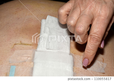 A woman's hand secures a bandage to a wound with tape. A woman's hand secures a bandage to a wound with tape. 110055817