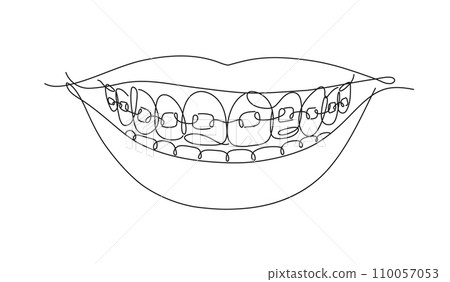 Smile with teeth braces flat line white color 110057053