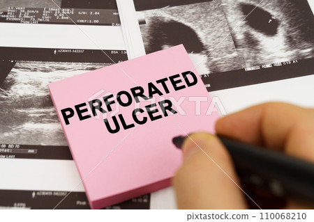 On the ultrasound pictures there are stickers that say - Perforated ulcer 110068210