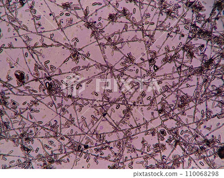 Observing powdery mildew spreading on leaves using a microscope 110068298
