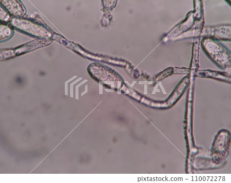 黴菌分生孢子的顯微照片 黴菌分生孢子的顯微照片 110072278