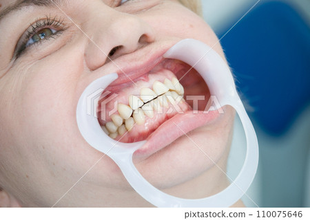 Teeth 110075646