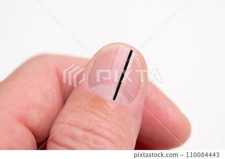 指甲上有黑色垂直線的圖像 110084443