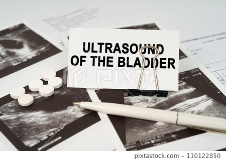 On the ultrasound pictures there is a pen and a business card with the inscription - Ultrasound of the bladder On the ultrasound pictures there is a pen and a business card with the inscription - Ultrasound of the bladder 110122850
