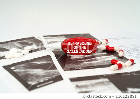 On the ultrasound pictures there are pills and a pen with the inscription - Ultrasound of the gallbladder On the ultrasound pictures there are pills and a pen with the inscription - Ultrasound of the gallbladder 110122851