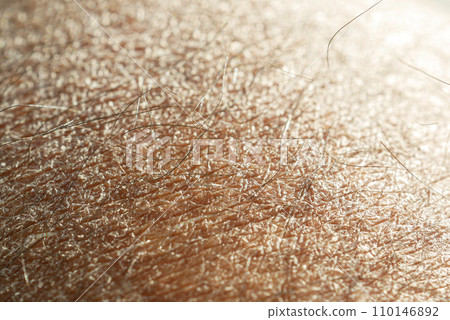 Closeup view of dry human skin . Closeup view of dry human skin . 110146892