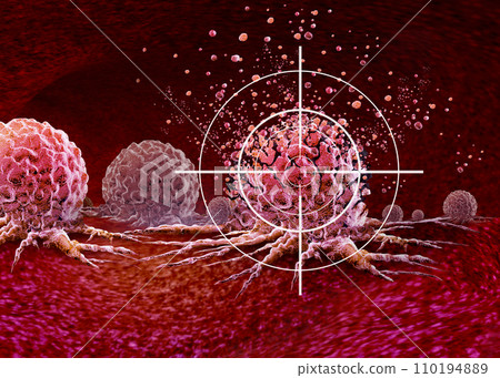 Ultrasound Cancer Treatment Ultrasound Cancer Treatment 110194889