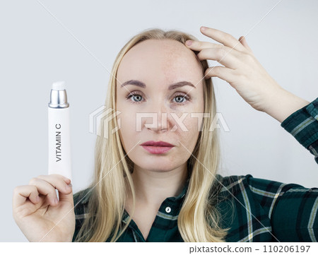 Vitamin A, Retinol, Niacinamide, Vitamin C. Girl smears her face with antioxidant anti-wrinkle cream. Anti-aging and facial rejuvenation agent. Before and after. Visual result. Acne treatment 110206197