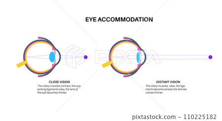 Eye accommodation poster 110225182