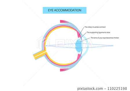 Eye accommodation poster Eye accommodation poster 110225198