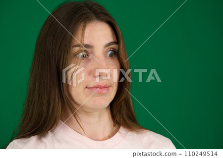 Macro closeup of young woman face with Grave's disease hyperthyroidism symptoms of ophthalmopathy bulging eyes proptosis edema Macro closeup of young woman face with Grave's disease hyperthyroidism symptoms of ophthalmopathy bulging eyes proptosis edema 110249514
