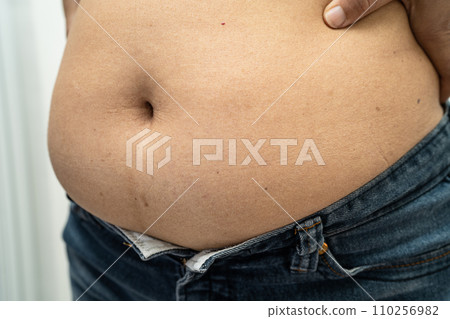 Overweight Asian woman show and use hand to squeeze fat belly. Overweight Asian woman show and use hand to squeeze fat belly. 110256982
