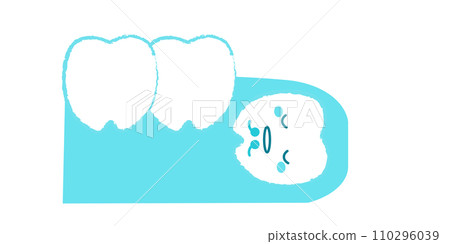 牙齒嵌入牙齦 藍色智齒插圖 110296039