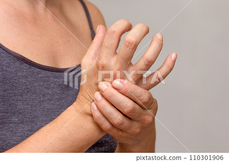 Woman hands showing hand with arthritis 110301906