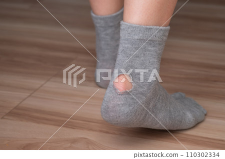 一位女士穿著有洞的襪子的圖片 一位女士穿著有洞的襪子的圖片 110302334