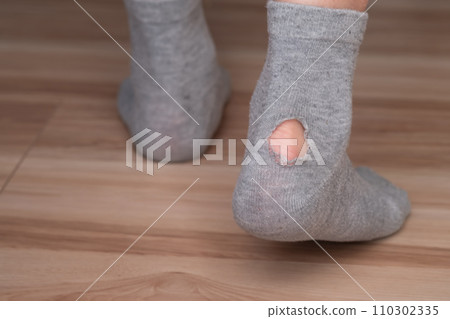 Image of a woman wearing socks with holes in them Image of a woman wearing socks with holes in them 110302335