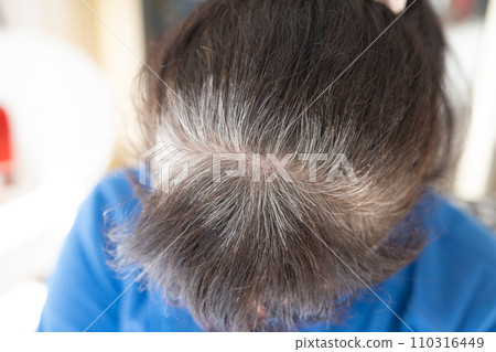 Head of an elderly woman with gray hair that grew after dyeing. Head of an elderly woman with gray hair that grew after dyeing. 110316449